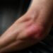 The Truth About Inflammation and Chronic Disease: Facts, Risks, and Effective Strategies