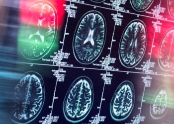 The doctor who mends broken brains: why there is room for hope after a stroke or head injury