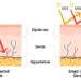 First new US sunscreen ingredient since 1999 approved by FDA – a skin scientist explains how bemotrizinol works