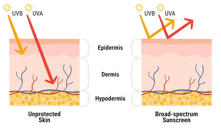 A graphic depiction of UVA and UVB rays penetrating the skin and their deflection with sunscreen.