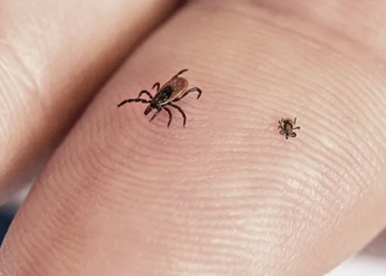 How to avoid tick bites in your yard or while hiking in the woods, and what to do if one starts feasting on you