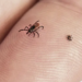 How to avoid tick bites in your yard or while hiking in the woods, and what to do if one starts feasting on you