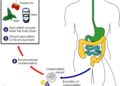 Cyclosporiasis sickens some people worse – why your diarrhea could be more explosive than others