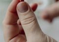 Flawed studies linking hormone therapy to breast cancer made doctors reluctant to prescribe it for menopause relief – especially for breast cancer survivors