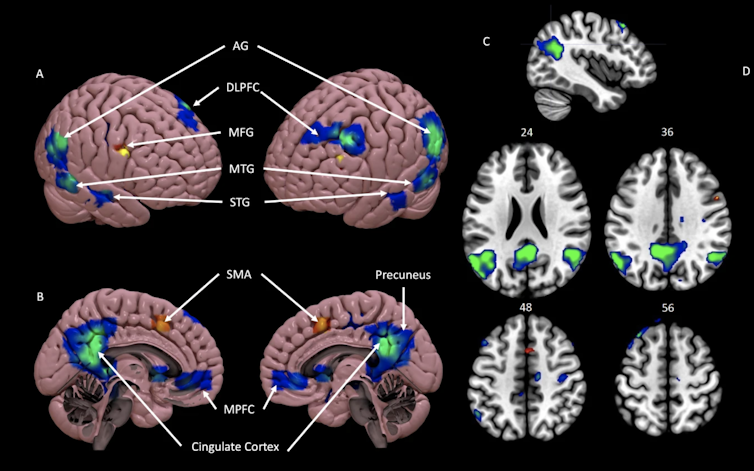 Images of the human brain with blue and green highlighted areas.