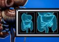 Nearly 1 in 100 Canadians has inflammatory bowel disease. Too many believe it rules out having children