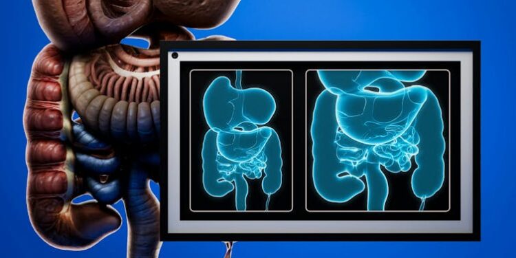 Nearly 1 in 100 Canadians has inflammatory bowel disease. Too many believe it rules out having children