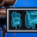 Nearly 1 in 100 Canadians has inflammatory bowel disease. Too many believe it rules out having children