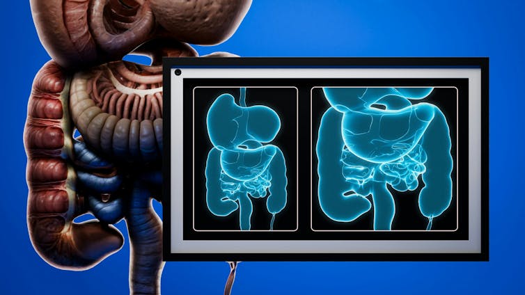 Illustration of human digestive system