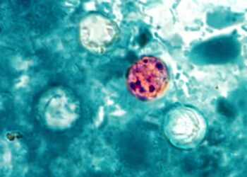 Cyclospora spreads through human waste – so how did it get on food?