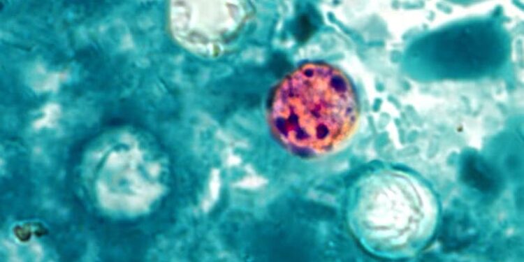 Cyclospora spreads through human waste – so how did it get on food?