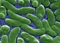 Flesh-eating bacteria are devouring limbs in warming waters worldwide − here’s how to protect yourself