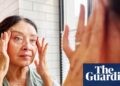 Ferritin face: the new health scare taking social media by storm