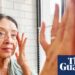Ferritin face: the new health scare taking social media by storm