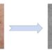 AI skin cancer detection tools are getting better – but only for people with light skin