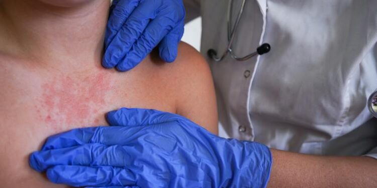 CDC vs. Pennsylvania: Why conflicting public health messages jeopardize public safety