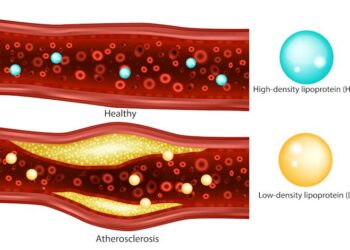 Cholesterol control gets personalized – a cardiologist explains how new guidelines tailor treatment to your unique risk profile