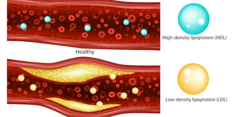 Cholesterol control gets personalized – a cardiologist explains how new guidelines tailor treatment to your unique risk profile