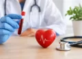 ApoB Testing Accuracy and Your Heart Risk