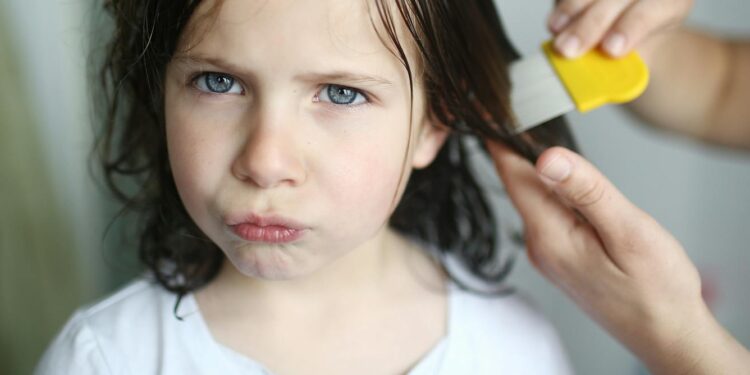 I’m a pediatrician and a mom – here’s how to treat lice without stigma