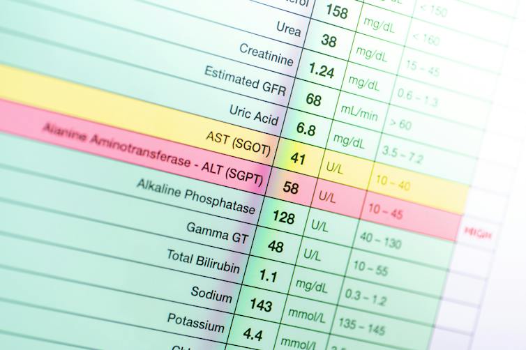 Grid of lab test results with AST and ALT showing abnormal levels